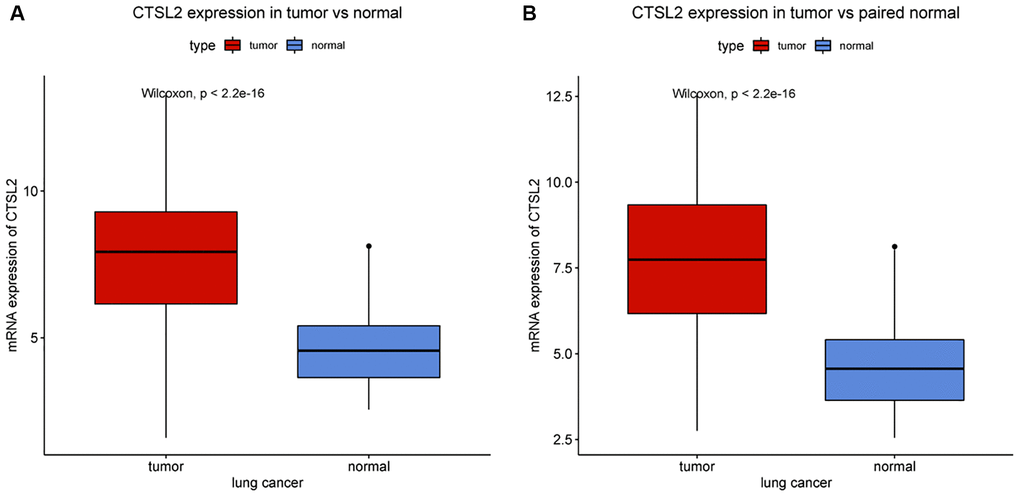 CTSL2 expression in lung adenocarcinoma tissues. (A) CTSL2 expression in normal and tumor tissues. (B) CTSL2 expression in paired tissues.