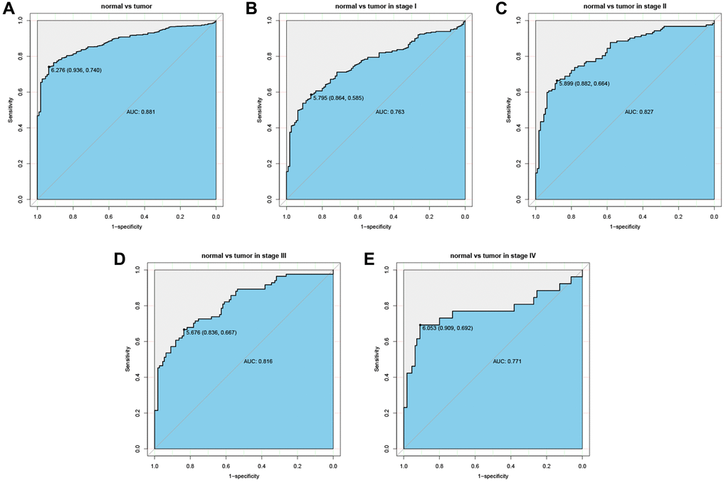 Diagnostic value of CTSL2 expression in lung adenocarcinoma. (A) ROC curve for CTSL2 in normal lung tissue and tumor; (B–E) Subgroup analysis for stage I, II, III, and IV.