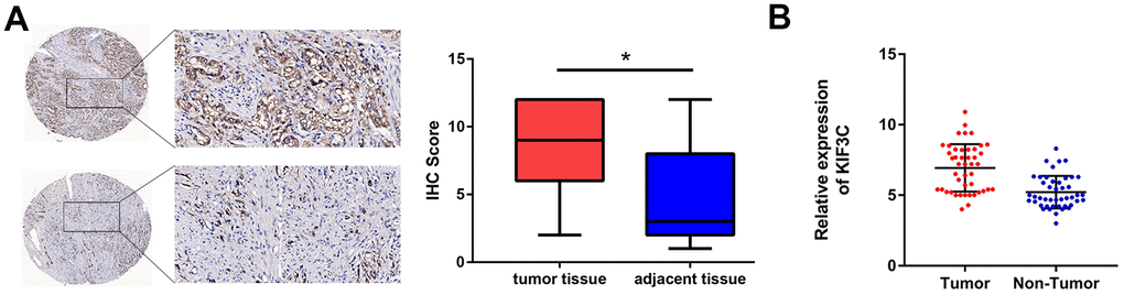 KIF3C is overexpressed in PCa. (A) Immunohistochemistry of tumor and adjacent tissues was conducted to show KIF3C levels (80 cases). (B) RT-qPCR showing KIF3C expression in tumor and adjacent tissues. Data are reported as means ± standard deviation of three independent experiments. *p 