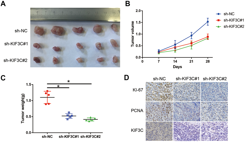 KIF3C silence prevented the proliferation of PC cells in vivo. (A) Represent image of nude mouse tumors (n=5). (B) The implanted tumor volume of the KIF3C knockdown PCa cells nude mouse. (C) The implanted tumor weight of the KIF3C knockdown PCa cells nude mouse. (D) Typical IHC staining images showing Ki-67, PCNA and KIF3C of the implanted tumors. Data are reported as means ± standard deviation of three independent experiments. *p 