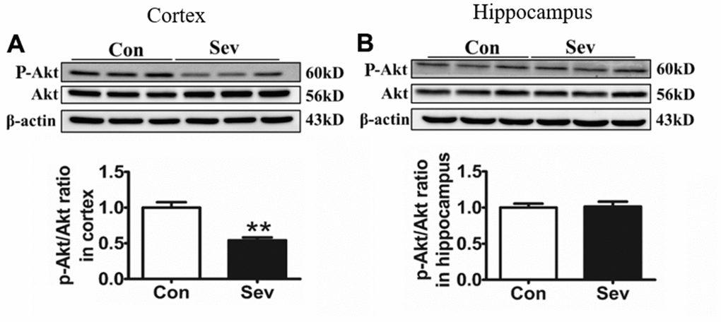 Sev significantly inhibited the phosphorylation of Akt in the cortex rather than the hippocampus. Effect of Sev on the expression of P-Akt in cortex (A) and hippocampus (B). Data are expressed as mean±SD, n=5 (**p