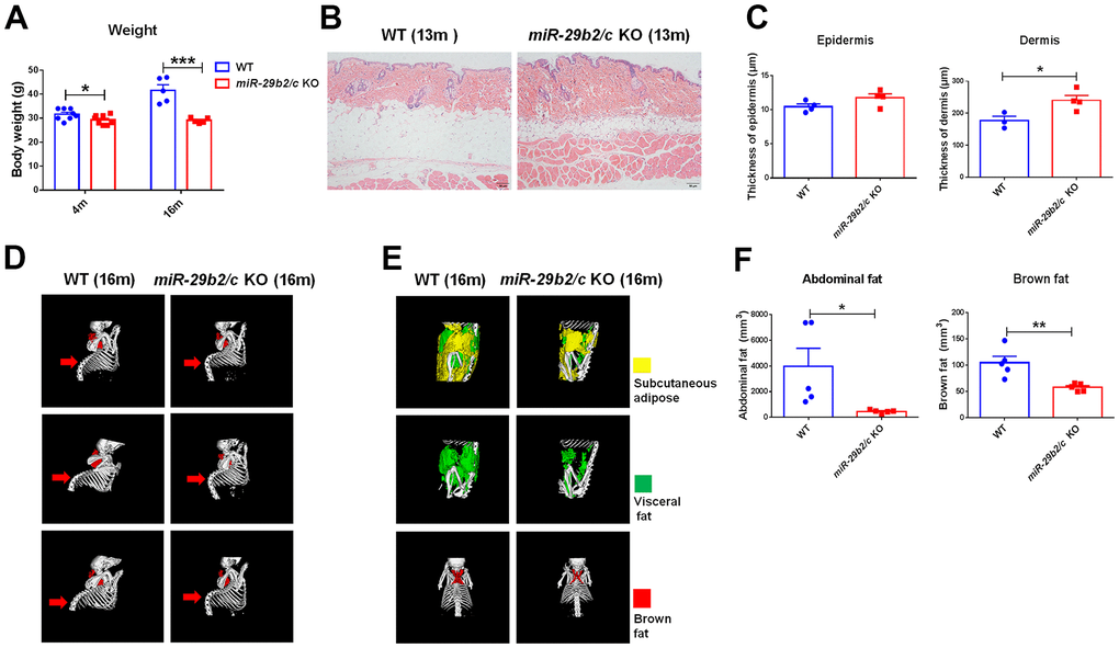 The body weights and the peripheral characteristics of miR-29b2/c KO mice. (A) The body weights of WT and miR-29b2/c KO mice at 4 and 16 months old. n=5-8. Differences were analyzed by Student-T-test. *p p B) H&E staining of the back skin of WT and miR-29b2/c KO mice at 13 months old. (C) The epidermis and dermis thickness of WT and miR-29b2/c KO mice at 13 months old. n=3-4. (D) microCT scan of bone of WT and miR-29b2/c KO mice at 16 months old. (E) microCT scan of abdominal fat (subcutaneous fat and visceral fat together) and brown fat of WT and miR-29b2/c KO mice at 16 months old. (F) The content and ratio analysis of abdominal and brown fat of WT and miR-29b2/c KO mice at 16 months old are shown. n=5. The differences were analyzed by Student-T-test. *p p 