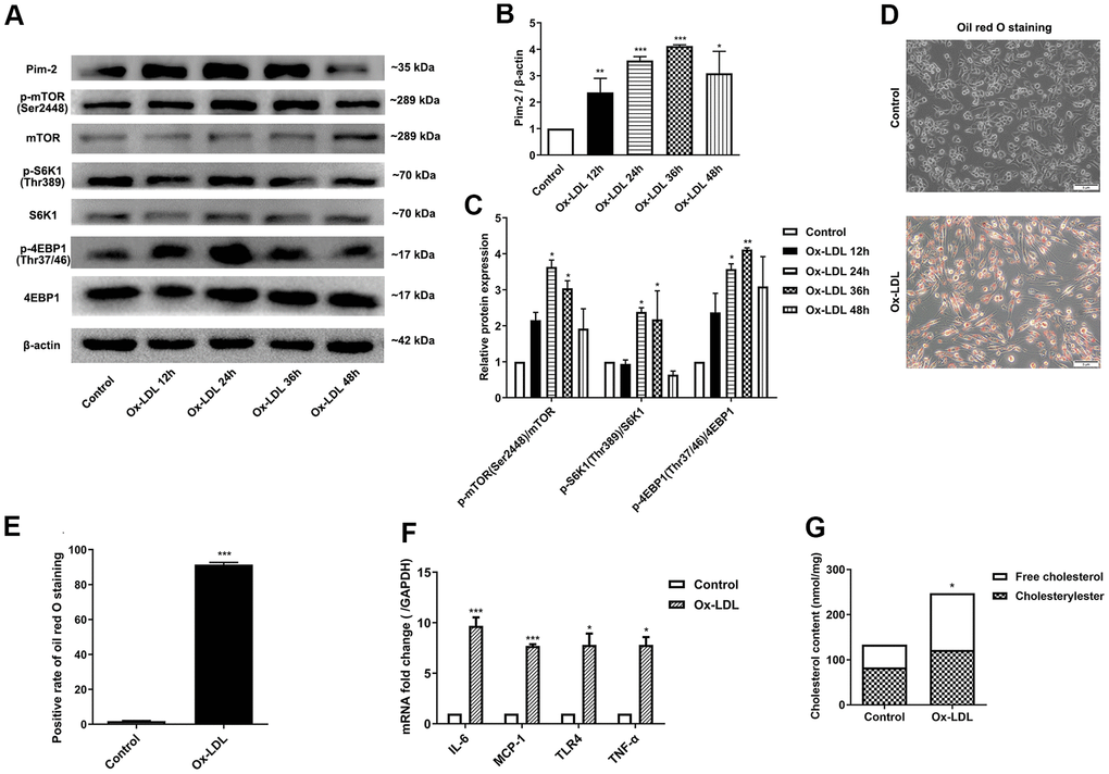 Ox-LDL upregulates the expression of Pim-2, the mTOR pathway and inflammatory cytokines in THP-1-derived macrophages. THP-1-derived macrophages were sequentially treated with 50 μg/ml of ox-LDL for 12 h, 24 h, 36 h, and 48 h. (A) Representative western blot analysis of Pim-2, p-mTOR (Ser2448) and mTOR, p-S6K1 (Thr389) and S6K1, and p-4EBP1 (Thr37/46) and 4EBP1. β-Actin was used as a loading control. (B, C) Corresponding densitometric analysis of blots in (A). (D) Intracellular lipid droplets were stained with oil red O working solution in THP-1-derived macrophages treated with 50 μg/ml of ox-LDL for 24 h. (E) Quantification of positive staining for lipid droplets (n=3 per group). (F) mRNA expression of inflammatory cytokines, including IL-6, MCP-1, TLR-4 and TNF-α, was determined by quantitative RT-PCR in ox-LDL-treated THP-1-derived macrophages; values normalized to the housekeeping gene GAPDH. (G) The concentrations of TC, FC, and CE were determined using the TC/FC Quantification Assay (n=3 per group). The data are represented as the means ± SD of three independent experiments; *P P P 