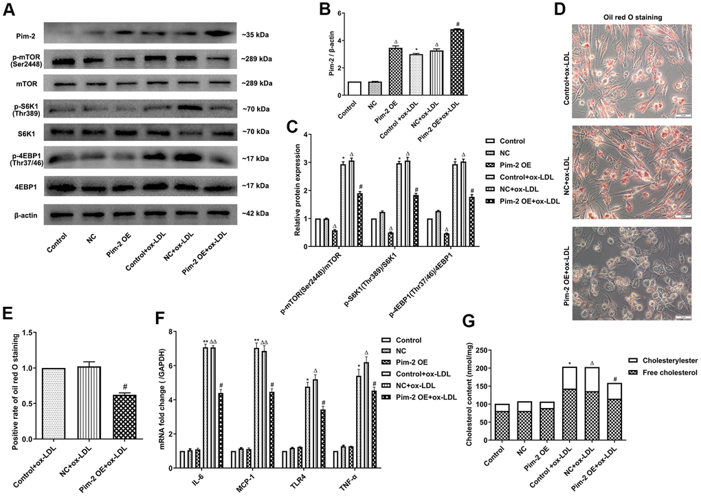 Overexpression of Pim-2 attenuates the inflammatory response in THP-1-derived macrophages. (A) Representative western blot analysis of Pim-2, p-mTOR (Ser2448) and mTOR, p-S6K1 (Thr389) and S6K1, and p-4EBP1 (Thr37/46) and 4EBP1 in ox-LDL-treated THP-1-derived macrophages after Pim-2 OE. β-Actin was used as a loading control. (B, C) Corresponding densitometric analysis of blots in (A). (D) Intracellular lipid droplets were stained with oil red O working solution in ox-LDL-treated THP-1-derived macrophages after Pim-2 OE. (E) Quantification of positive staining for lipid droplets (n=3 per group). (F) mRNA expression of inflammatory cytokines, including IL-6, MCP-1, TLR-4 and TNF-α, was determined by quantitative RT-PCR in ox-LDL-treated THP-1-derived macrophages after Pim-2 OE; the values were normalized to the housekeeping gene GAPDH. (G) The concentrations of TC, FC, and CE were determined using the TC/FC Quantification Assay (n=3 per group). The data are represented as the means ± SD of three independent experiments; *P P ΔP ΔΔP #P 