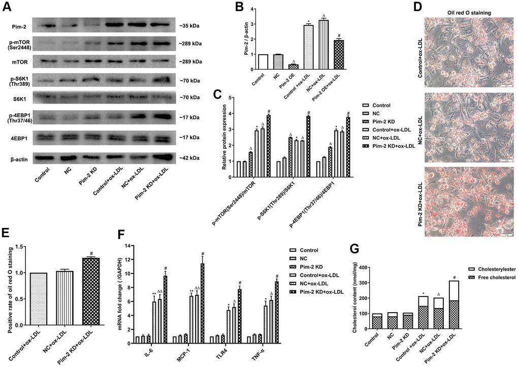 Silencing of Pim-2 promotes the inflammatory response in THP-1-derived macrophages. (A) Representative western blot analysis of Pim-2, p-mTOR (Ser2448) and mTOR, p-S6K1 (Thr389) and S6K1, and p-4EBP1 (Thr37/46) and 4EBP1 in ox-LDL-treated THP-1-derived macrophages after Pim-2 KD. β-Actin was used as a loading control. (B, C) Corresponding densitometric analysis of blots in (A). (D) Intracellular lipid droplets were stained with oil red O working solution in ox-LDL-treated THP-1-derived macrophages after Pim-2 KD. (E) Quantification of positive staining for lipid droplets (n=3 per group). (F) mRNA expression of inflammatory cytokines, including IL-6, MCP-1, TLR-4 and TNF-α, was determined by quantitative RT-PCR in ox-LDL-treated THP-1-derived macrophages after Pim-2 KD; the values were normalized to the housekeeping gene GAPDH. (G) The concentrations of TC, FC, and CE were determined using the TC/FC Quantification Assay (n=3 per group). The data are represented as the means ± SD of three independent experiments; *P P ΔP ΔΔP #P 