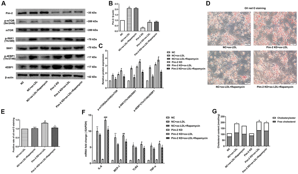 mTOR inhibitor treatment rescues the proinflammatory effect of Pim-2 KD in THP-1-derived macrophages. (A) Representative western blot analysis of Pim-2, p-mTOR (Ser2448) and mTOR, p-S6K1 (Thr389) and S6K1, and p-4EBP1 (Thr37/46) and 4EBP1 in rapamycin-exposed ox-LDL-treated THP-1-derived macrophages after Pim-2 KD. β-Actin was used as a loading control. (B, C) Corresponding densitometric analysis of blots in (A). (D) Intracellular lipid droplets were stained with oil red O working solution in rapamycin-disposed ox-LDL-treated THP-1-derived macrophages after Pim-2 KD. (E) Quantification of positive staining for lipid droplets (n=3 per group). (F) mRNA expression of inflammatory cytokines, including IL-6, MCP-1, TLR-4 and TNF-α, was determined by quantitative RT-PCR in rapamycin-treated ox-LDL-treated THP-1-derived macrophages after Pim-2 KD; the values were normalized to the housekeeping gene GAPDH. (G) The concentrations of TC, FC, and CE were determined using the TC/FC Quantification Assay (n=3 per group). The data are represented as the means ± SD of three independent experiments; *P P &P #P ##P ###P ΔP 