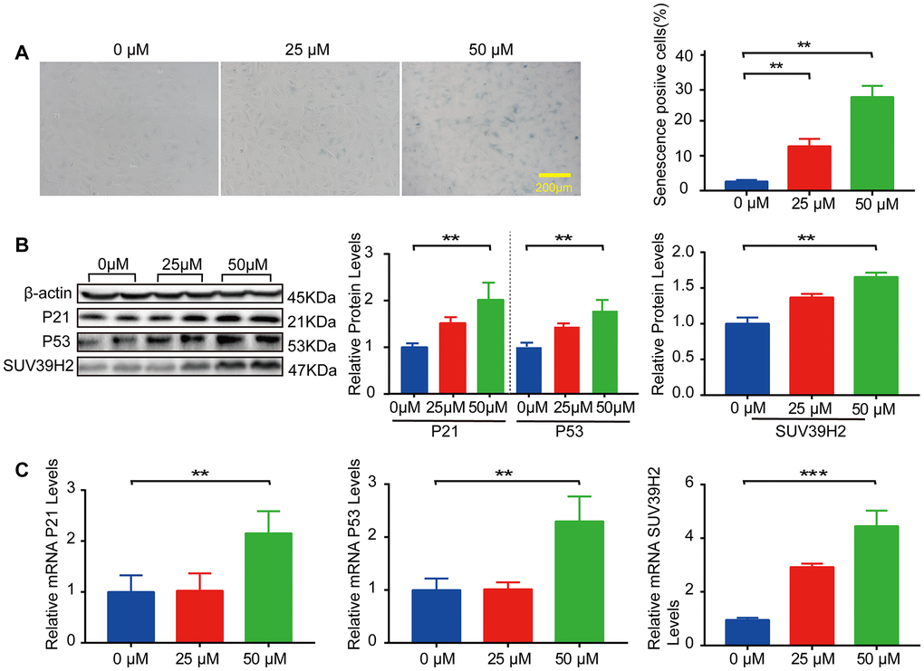 SUV39H2 is increased in a cardiomyocyte senescence model induced by H2O2. (A–C) Effects of different concentrations of H2O2 on senescence of H9C2 cells. (A) SA-β-Gal staining of H9C2 cells treated with H2O2 concentration in 0, 25, 50 uM groups. (B) Expression of p21, p53, and SUV39H2 in the cells treated with a concentration gradient was detected by western blotting. (C) RT-PCR was used to quantify the expression of p21, p53, and SUV39H2 in above groups. All the experiments have been repeated independently at least 3 times. Scale bars, 200 μm. *P **P ***P 