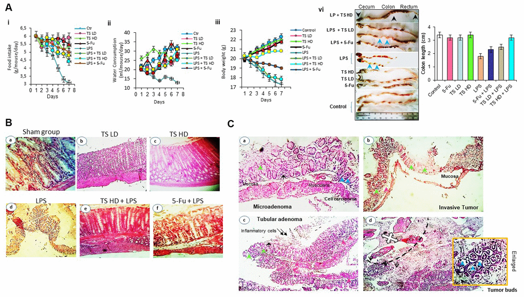 (A) Food intake (ii), water consumption (iii), body weight (vi) of mice treated with thyme essential oil (12.5 mg/ml and 50 mg/ml), LPS or both LPS and essential oil and colon length (vi) of different groups treated with drugs. (B) Histomorphological evaluation of mouse bearing colon tumor. a-d: normal colon mucosal with intact epithelium; e, f: colon carcinoma; g, h: mild injuries in colon; i: tissues damage (H&E staining, Magnification b, c, e ×10; a, d, f ×40). (C) Photomicrograph showing colon colorectal adenocarcinoma in LPS-treated groups. Microadenoma (a); invasive adenocarcinoma (b); tubular adenoma with inflammatory cells (c) and tumor buds (d). Black arrows-inflammatory cell infiltration within mucosa and pink arrows-inflammatory cell infiltration within submucosa; blue arrow-cancer cells, green arrows-crypt and goblet cell loss (H&E staining, Magnification ×40).