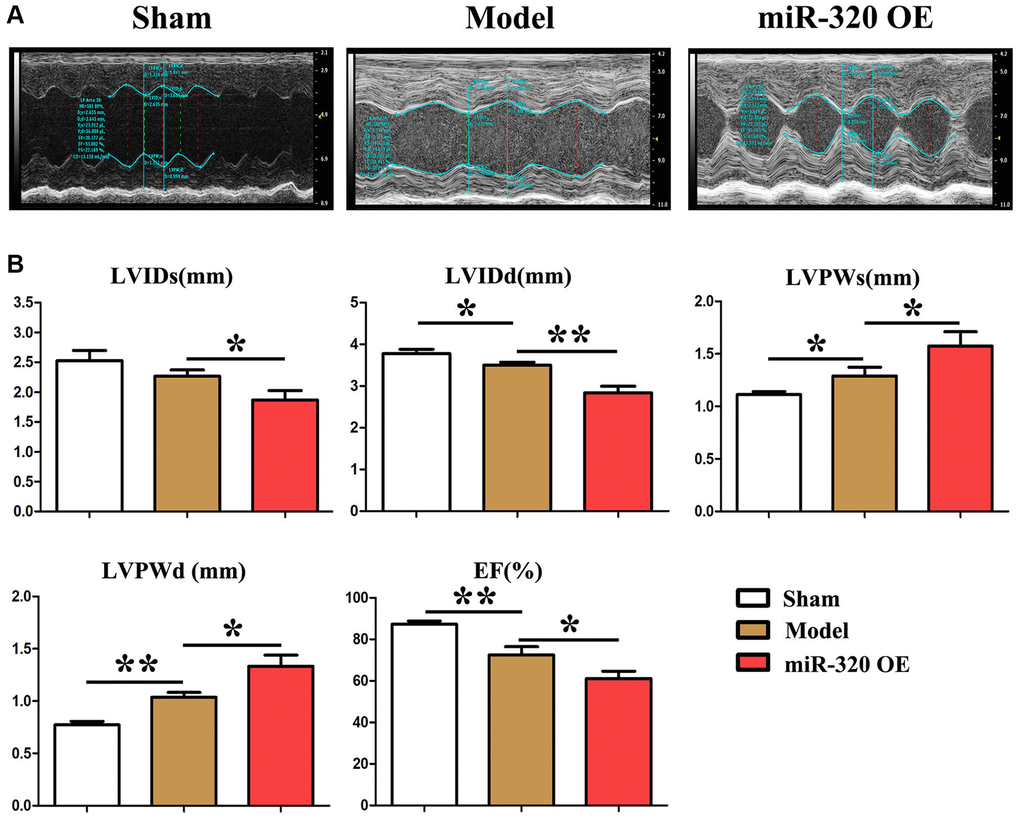 MiR-320 OE induced left ventricular (LV) hypertrophy and cardiac fibrosis. (A) Representative serial M-mode echocardiography in conscious sham and miR-320 OE and model mice measured before and after TAC; (B) Summary data of left ventricular internal dimension diastole (LVIDd), left ventricular internal dimension systole (LVIDs), left ventricular posterior wall dimensions diastole (LVPWd), left ventricular posterior wall dimensions systole (LVPWDs), and ejection fraction (E.F.). P 