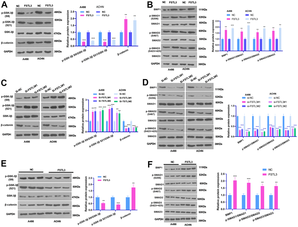 FSTL3 modulated GSK-3β/β-catenin pathway activation. (A, B) The A498 and ACHN cells were transiently transfected along with the overexpression plasmids of FSTL3. Western Blot experiment was done to verify the protein expressions of GSK-3β/β-catenin, and BMP1, SMAD1, SMAD2, and SMAD3 in RCC cells. (C, D) The A498 and ACHN cells were transiently transfected along with si-FSTL3. Western Blot was implemented to check the protein profiles of GSK-3β/β-catenin, and BMP1, SMAD1, SMAD2, and SMAD3 in RCC cells. (E, F) Western blot examined GSK-3β, β-catenin, BMP1, SMAD1, SMAD2, and SMAD3 in the formed tumor tissues. **PP