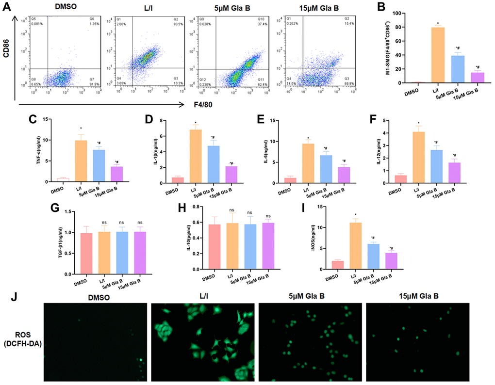 The effect of Gla B on SMG M1 polarization. (A–B) Detection of the ratio of F4/80+CD86+ M1 type cells by flow cytometry. LPS/IFN-γ could promote SMG M1 type polarization. Gla B could inhibit polarization and decrease the ratio of F4/80+CD86+ cells. Comparison with DMSO, *P #P C–F) and (I) Detection of M1 type cell marker. After LPS and IFN-γ treatment to induce M1 polarization, the levels of TNF-α, IL-1β, IL-6, iNOS and IL-12 were significantly up-regulated, and Gla B could inhibit the up-regulation of cytokines. Comparison with DMSO, *P #P G–H) Detection of M2 type cell marker. After LPS and IFN-γ treatment to induce M1 polarization, the expression of TGF-β1 and IL-10 was not significantly changed, while Gla B also had no effect on the expression of TGF-β1 and IL-10. nsP J) Detection of ROS by DCFH-DA. After LPS and IFN-γ treatment to induce M1 polarization, the expression of ROS was significantly up-regulated while Gla B inhibited the expression of ROS.