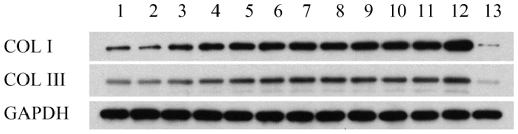Collage I and collage III protein expression in lung tissues detected by western blot analysis. Lane 1, control group; lane 2, PQ with concentrations of 50 μmol/L was selected for 24h; lane 3, PQ with concentrations of 50 μmol/L was selected for 48h; lane 4, PQ with concentrations of 50 μmol/L was selected for 72h; lane 5, PQ with concentrations of 100 μmol/L was selected for 24h; lane 6, PQ with concentrations of 100 μmol/L was selected for 48h; lane 7, PQ with concentrations of 100 μmol/L was selected for 72h; lane 8, PQ with concentrations of 150 μmol/L was selected for 24h; lane 9, PQ with concentrations of 150 μmol/L was selected for 48h; lane 10, PQ with concentrations of 150 μmol/L was selected for 72h; lane 11, PQ with concentrations of 200 μmol/L was selected for 24h; lane 12, PQ with concentrations of 200 μmol/L was selected for 48h; lane 12, PQ with concentrations of 200 μmol/L was selected for 72h.
