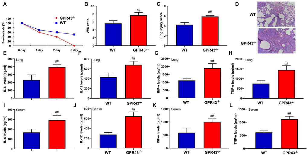 The inhibition of GPR43 gene is associated with future risk of sepsis-induced inflammatory reactions. Survival rate (A) in tissue of CLP mice for 72 h; W/D rate (B), lung injury score (C) and lung tissue using HE staining (D) in CLP mice for 24 h; IL-6 (E), IL-10 (F), IL-12 (G) and INF-γ (H) levels in tissue of CLP mice for 24 h; IL-6 (I), IL-10 (J), IL-12 (K) and INF-γ (L) levels in serum of CLP mice for 24 h. WT, WT mice with CLP; GPR43-/-, GPR43-/- mice with CLP. ##p