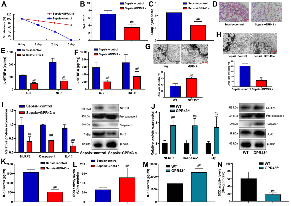 GPR43 agonist is involved in sepsis-induced inflammatory reactions through trigger NLRP3 inflammasome. Survival rate (A) in CLP mice with GPR43 agonist (4-CMTB, 10 mg/kg, i.p.) for 72 h; W/D rate (B), lung injury score (C) and lung tissue using HE staining (D) in CLP mice with GPR43 agonist (4-CMTB, 10 mg/kg, i.p.) for 24 h; IL-6/IL-10 levels in tissue of CLP mice (E) in CLP mice with GPR43 agonist (4-CMTB, 10 mg/kg, i.p.) for 24 h; IL-6/IL-10 levels in serum of CLP mice (F) in CLP mice with GPR43 agonist (4-CMTB, 10 mg/kg, i.p.) for 24 h; Representative electron microscopy images and area void of cristae (minimum of 40 mitochondria) was used to measure mitochondrial cristae density in macrophage CLP of mice with GPR43 agonist (4-CMTB, 10 mg/kg, i.p.) (G) for 24 h; Representative electron microscopy images and area void of cristae (minimum of 40 mitochondria) was used to measure mitochondrial cristae density in macrophage CLP of mice with GPR43 agonist (4-CMTB, 10 mg/kg, i.p.) (H) for 24 h; NLRP3, Caspase-1 and IL-1β protein expressions in CLP mice with GPR43 agonist (4-CMTB, 10 mg/kg, i.p.) (I) for 24 h; NLRP3, Caspase-1 and IL-1β protein expressions in GPR43-/- mice of CLP (J) for 24 h; Serum IL-1β and SOD levels in CLP mice with GPR43 agonist (4-CMTB, 10 mg/kg, i.p.) (K, L) for 24 h; Serum IL-1β and SOD levels in GPR43-/- mice of CLP (M, N) for 24 h. Sepsis+control, CLP mice with normal saline; Sepsis+GRP43 a, CLP mice with i GPR43 agonist (4-CMTB, 10 mg/kg, i.p.); WT, WT mice with CLP; GPR43-/-, GPR43-/- mice with CLP. ##p