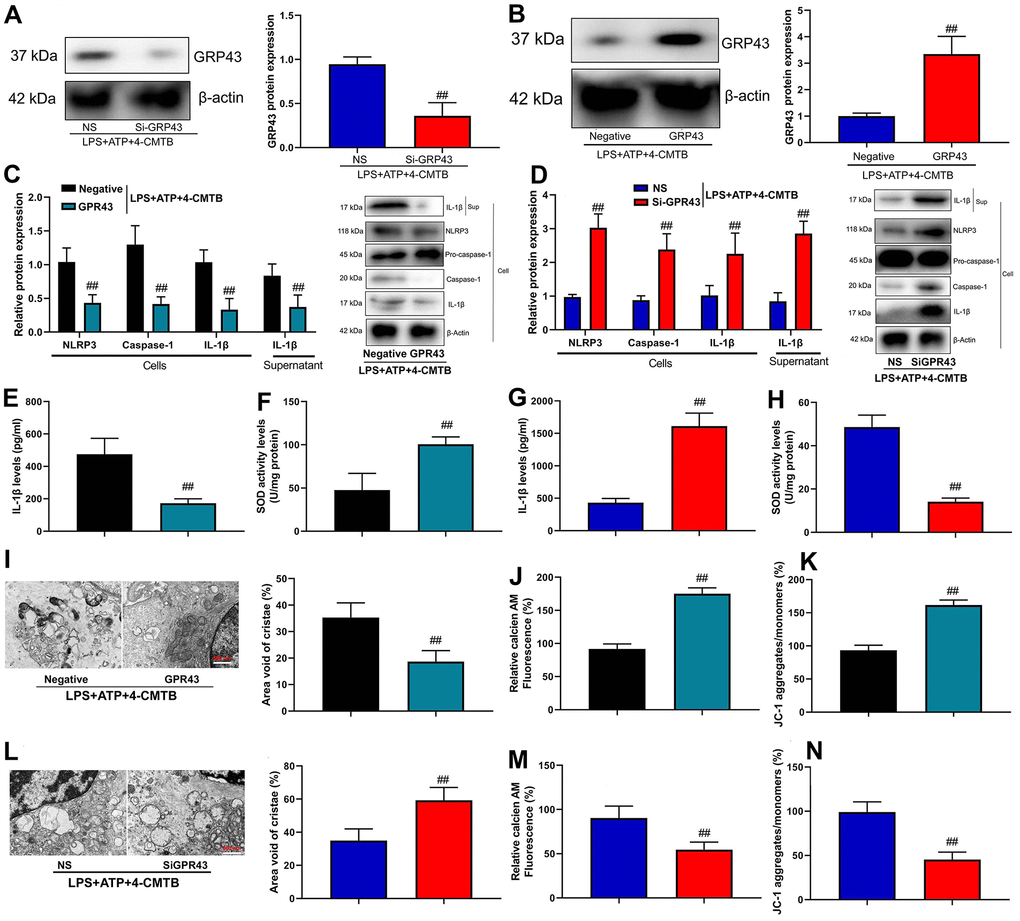 GPR43 gene trigger NLRP3 inflammasome in macrophage by regulation of mitochondrial fission. GPR43 protein expression in macrophage by down-regulation of GPR43 and LPS+ATP+GPR43 agonist (A); GPR43 protein expression in macrophage by up-regulation of GPR43 and LPS+ATP+GPR43 agonist (B); NLRP3, Caspase-1 and IL-1β protein expressions in cells and IL-1β protein expression in macrophage by up-regulation of GPR43 and LPS+ATP+GPR43 agonist (C); NLRP3, Caspase-1 and IL-1β protein expressions in cells and IL-1β protein expression in macrophage by down-regulation of GPR43 and LPS+ATP+GPR43 agonist (D); IL-1β and SOD levels in macrophage by up-regulation of GPR43 and LPS+ATP+GPR43 agonist (E, F); IL-1β and SOD levels in macrophage by down-regulation of GPR43 and LPS+ATP+GPR43 agonist (G, H); Representative electron microscopy images, area void of cristae (minimum of 40 mitochondria) was used to measure mitochondrial cristae density (I), Calcein-AM/CoCl2 assay (J), and Calcein-AM/CoCl2 assay and dissipation of Δψm by JC-1 assay (K) in macrophage by up-regulation of GPR43 and LPS+ATP+GPR43 agonist; Representative electron microscopy images, area void of cristae (minimum of 40 mitochondria) was used to measure mitochondrial cristae density (L), Calcein-AM/CoCl2 assay (J), and Calcein-AM/CoCl2 assay and dissipation of Δψm by JC-1 assay (M) in macrophage by down-regulation of GPR43 and LPS+ATP+GPR43 agonist (N). Negative, negative control; GPR43, over-expression of GPR43; NS, si-negative control; Si-GPR43, down-regulation of GPR43; LPS+ATP+4-CMTB, macrophage by treated with LP+ATP+4-CMTB. ##p