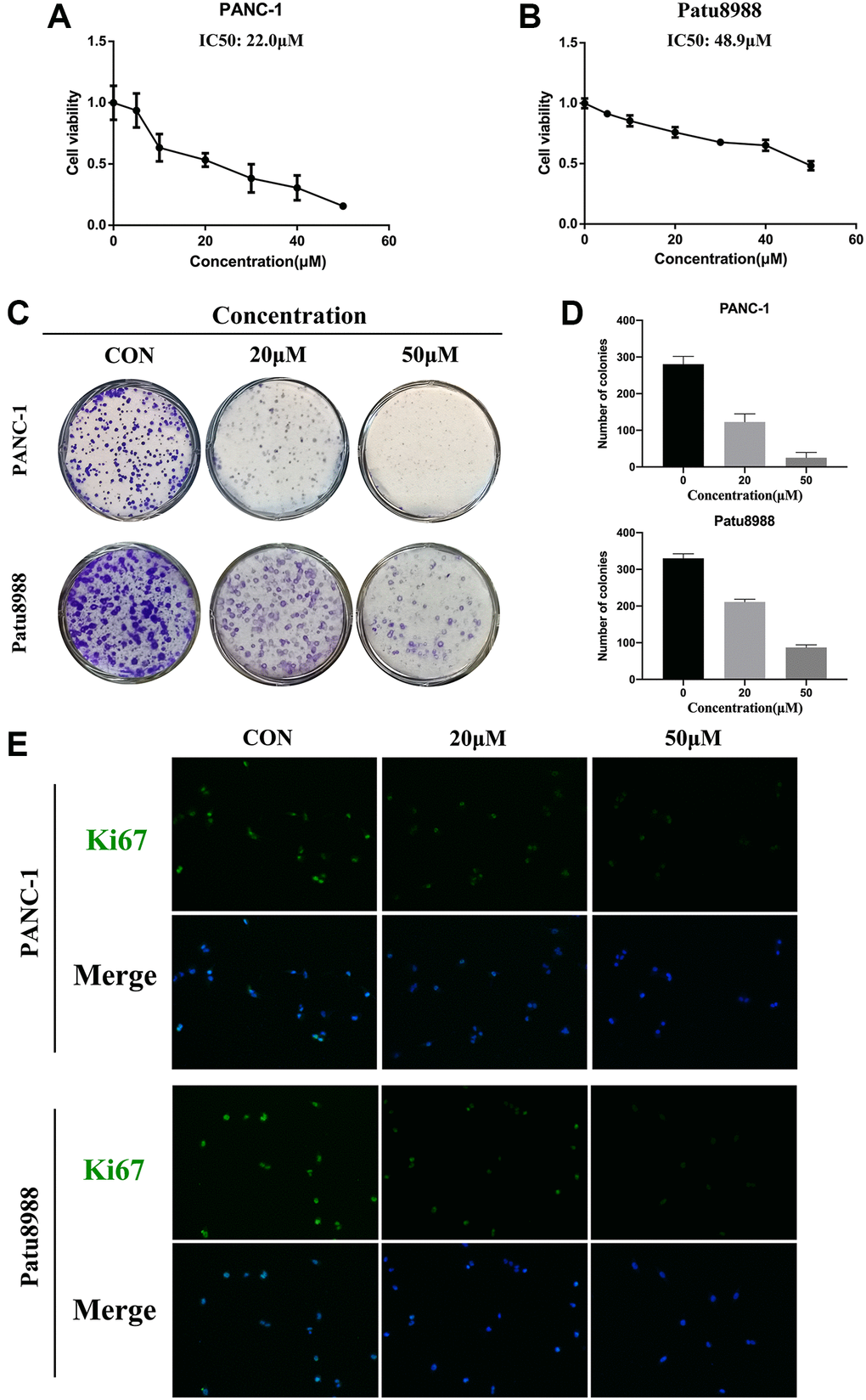 Panaxadiol suppressed the proliferation of human pancreatic cancer cells. (A–B) The cell viability of PANC-1 and Patu8988 was detected by CCK8 assays. The IC50 values of panaxadiol for PANC-1 and Patu8988 cells were 22.0 μM and 48.9 μM correspondingly. PANC-1 and Patu8988 were treated with different concentrations of panaxadiol as soon as they were seeded in 96-well plates, and then they were incubated for 24 h. (C–D) Colony formation assays showed the proliferation of pancreatic cancer cells was suppressed. When the cells were plated in a 6-well plate and incubated for 24 h, 0, 20 μM, and 50 μM of panaxadiol was added to each well. After 14 days, the cells were fixed and stained with crystal purple to count the number of colonies. The results were presented as mean ± SD; *P E) Ki67 immunofluorescence staining showed the Ki67 positive cells decreased after the treatment of panaxadiol.