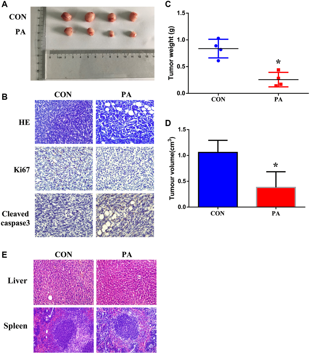 Panaxadiol suppressed tumor growth and reduced weights in xenograft pancreatic cancer models. (A) General changes of xenograft cancer models were by panaxadiol. (B) HE staining showed the pathological effect of panaxadiol between control and experimental groups, and immunohistochemical staining demonstrated the changes of Ki67 and Cleaved-caspase3 in tissues. (C–D) Panaxadiol significantly decreased the tumor weight and volume compared to control groups after being treated for 30 days. *P E) The HE staining of liver and spleen. In vivo, panaxadiol possessed almost no cytotoxicity against normal tissues.