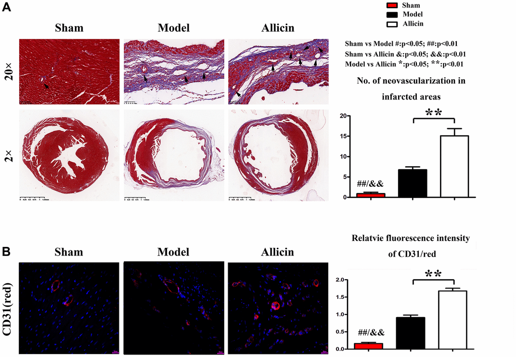 Allicin’s effect on the MI/R was associated with increased capillary angiogenesis in the peri-infarct area. (A) Masson staining of myocardial sections showed that the numbers of neovascularization was increased in myocardium Model group compared with the Control group, and the Allicin group's capillary angiogenesis was increased compared with the Model group (*P B) Immunohistochemical staining for myocardial lactate dehydrogenase (green) and CD31(red) in the peri-infarct area showed that Compared with the Control group, the expression level of CD-31 was upregulated in myocardium Model group, while Allicin treatment further increased capillary angiogenesis compared with the Mode (*P 