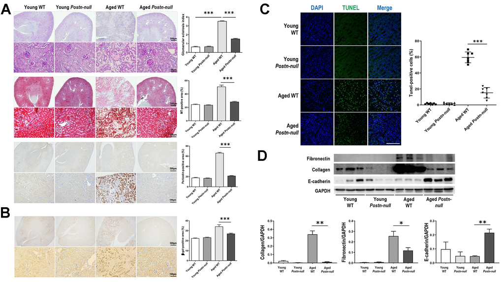 Role of periostin in renal fibrosis due to aging. (A) Tubular atrophy, interstitial fibrosis, glomerular sclerosis, and periostin expression were increased in aged WT mice, but not so much in aged Postn-null mice. Representative data are shown (N = 7/group). Magnification: 40× (top); 400× (bottom); 200× (bottom). Data are the mean ± SEM. ***p t-test). (B) Beta-galactosidase expression was increased in aged WT mice, but a lesser extent in aged Postn-null mice. Representative data are shown (N = 7/group). Magnification: 40× (top); 200× (bottom). Data are the mean ± SEM. ***p t-test). (C) Apoptotic cells were significantly increased in aged WT, but to a markedly lower level in aged Postn-null mice. Data are the mean ± SEM. ***p t-test). (D) The expression of fibrosis markers was increased in aged WT mice, but not so much in aged Postn-null mice. Data are the mean ± SEM. *p p p t-test).