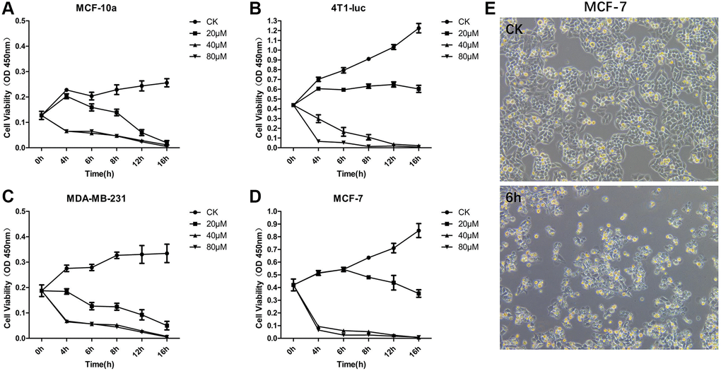 OA inhibited the cell proliferation of MCF-7 Cells. MCF-10a (A), 4T1-luc (B), MDA-MB-231 (C) and MCF-7 (D) cells were treated with OA in three concentration gradients 20 μM, 40 μM and 80 μM for 16 hours (16 h), and the cell activity of each group was then detected by CCK-8. MCF-7 cells were observed at 6 hours after OA treatment and in the control group (CK) (E). Values are mean ± SD (n = 5). The cell viability was observed in OD 450 nm.