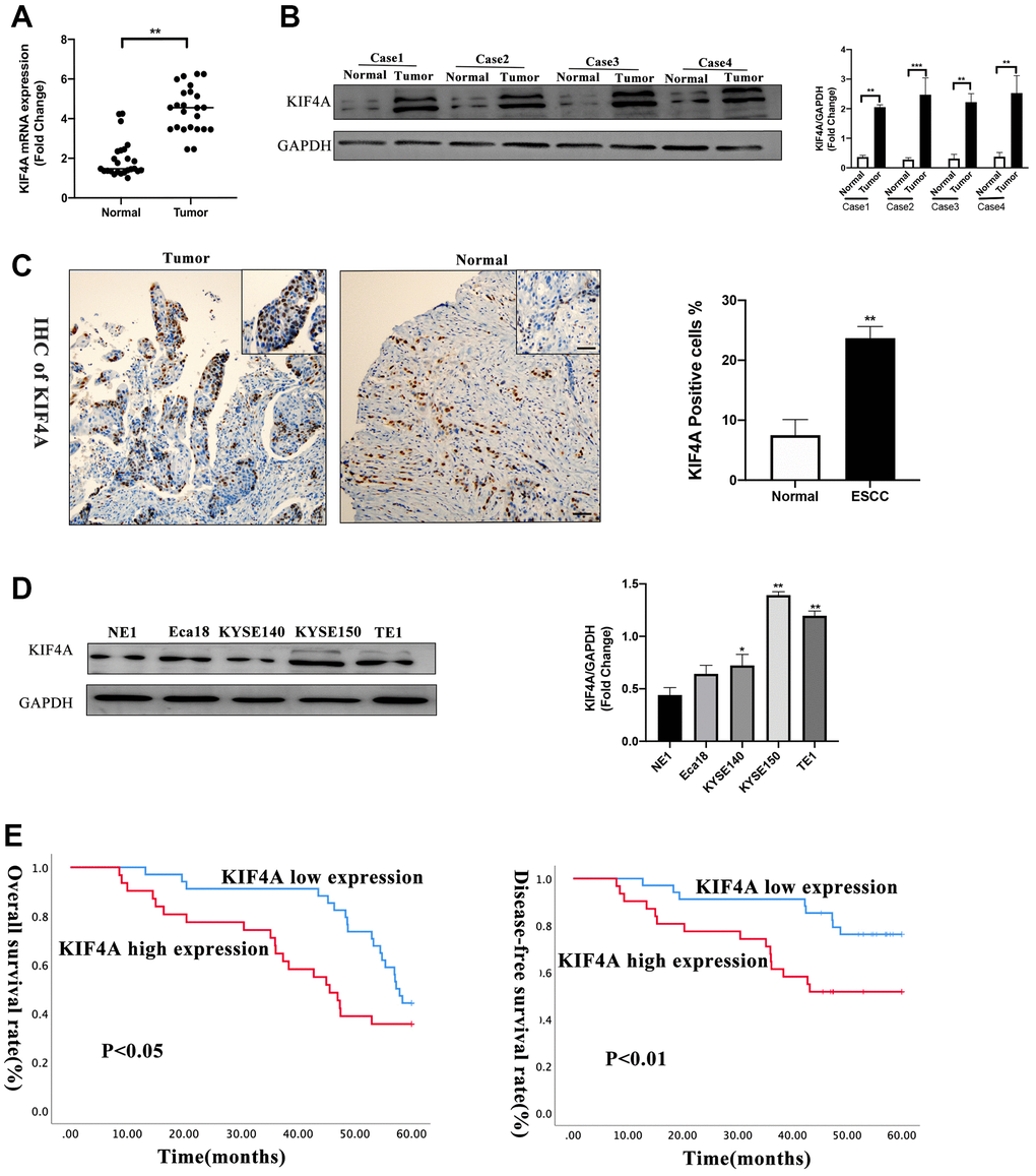 KIF4A was upregulated in ESCCs and ESCC cell lines. KIF4A expression was compared by qRT-PCR (A), WB (B), immunohistochemistry (IHC) (scale bar 50 um) (C) between tumor and corresponding non-tumor tissues in 25 ESCCs. Expression of KIF4A was detected in the ESCC cell lines by WB analysis compared with an immortalized esophageal epithelial cell line NE1 (D). Kaplan–Meier analysis showed the overall survival rate and disease-free survival rate of ESCC patients stratified by KIF4A expression (E). Data were presented as mean ± SEM. *p **p ***p 