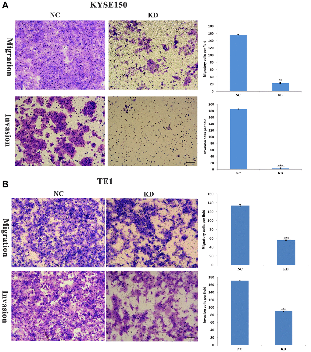 KIF4A facilitated invasion and migration of ESCC cells. Transwell assay was performed to compare migration and invasion between cells treated with shRNAs and NC. The representative images of migrated and invasive cells are shown (A–B) (scale bar 50 um). The presented figures are representative data from at least three independent experiments. *P **P ***P 