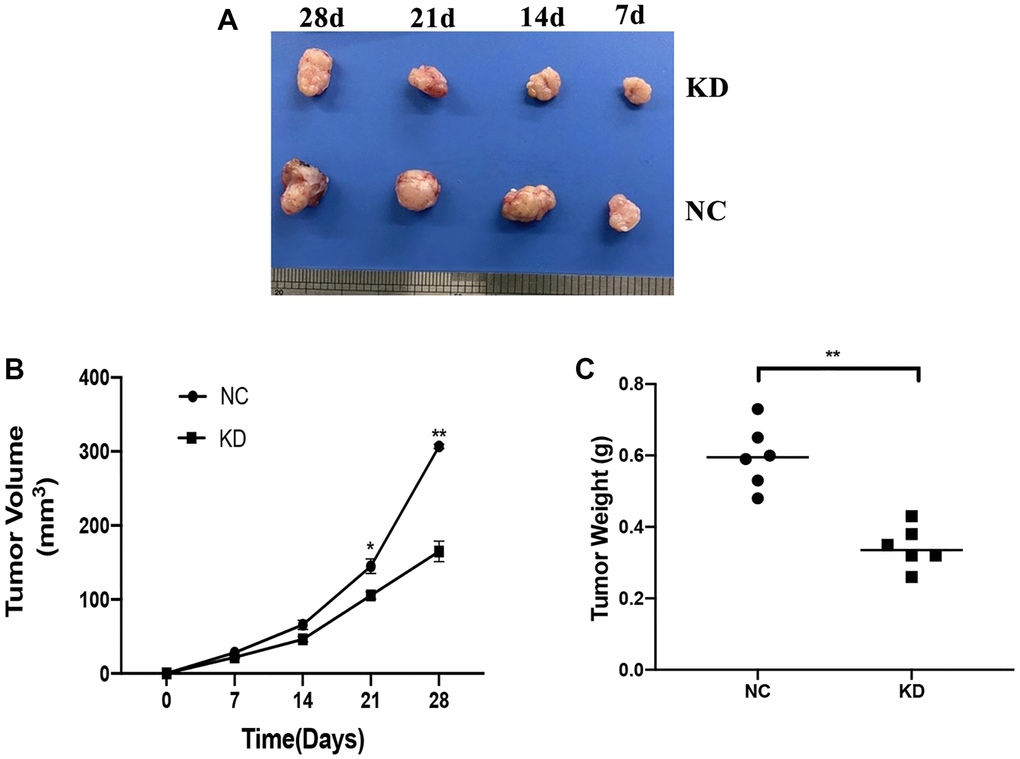 Effects of KIF4A on ESCC cell growth in vivo. Image of xenograft tumors (A). Growth curves of xenograft tumors formed by indicated KYSE150 cells in nude mice (B). Weight of xenograft tumors (C). Data represent mean ± SD (n = 6). *p **p ***p 