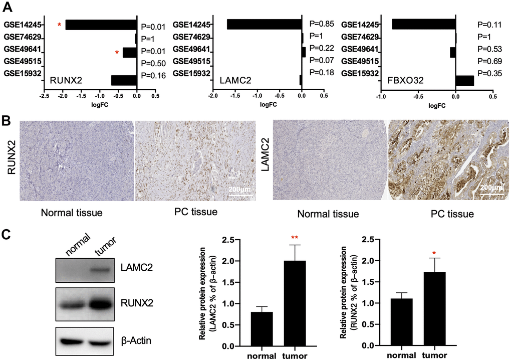 Verification of key genes. (A) RUNX2, LAMC2 and FXBO32 expression levels (Log2FoldChange value) in GSE14245, GSE74629, GSE49641, GSE49515 and GSE15932. (B) Representative immunohistochemistry staining of RUNX2 and LAMC2 in pancreatic ductal adenocarcinoma (PC tissue) and control pancreatic tissue (Normal tissue) in Human Protein Atlas (HPA). Scales bars represent 200 μm. (C) Western blot analysis for RUNX2 and LAMC2 expression proteins in 16 paired samples from PC patients.