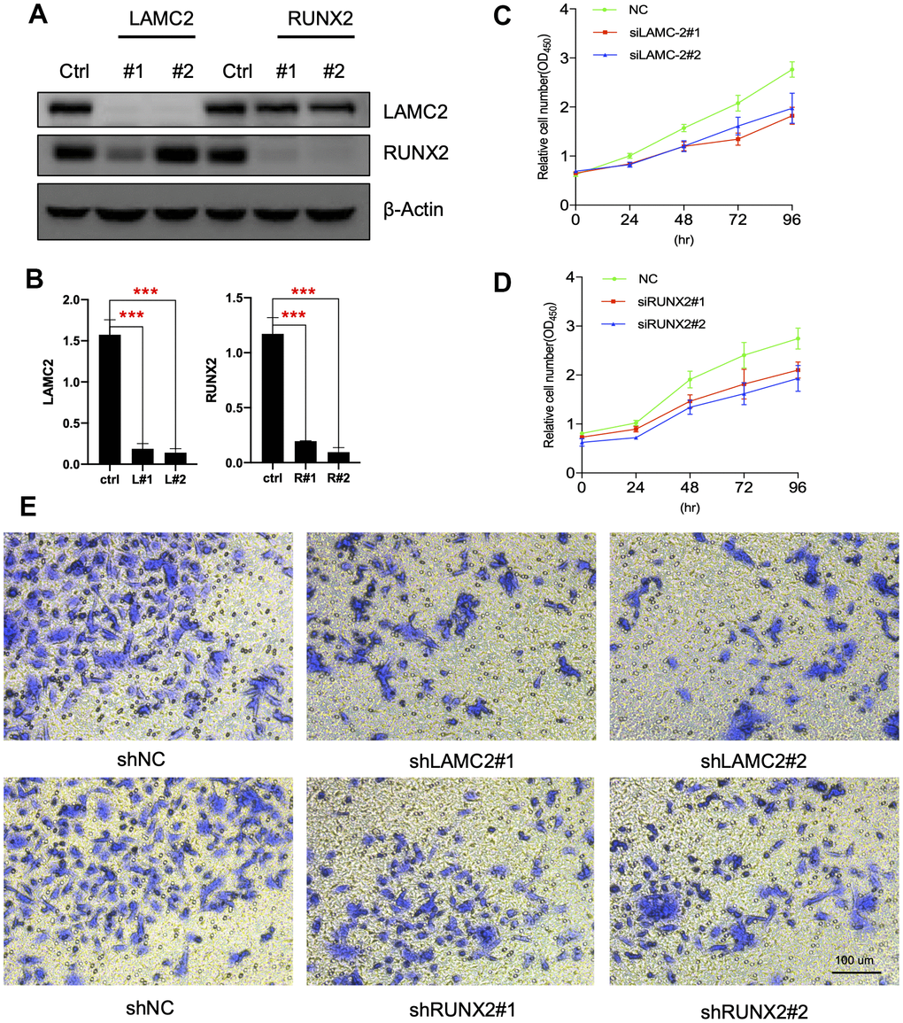 LAMC2 and RUNX2 participate in PC cell growth and migration. (A, B) ASPC-1 cells were transfected with control shRNA (NC) or two shRNAs of different sequences targeting LAMC2 or RUNX2 for 48 h; cell samples were collected and subjected to western blot analysis. (C, D) Cell growth curves of control, LAMC2- and RUNX2-depleted cells were measured by RTCA (Real Time Cellular Analysis). (E) Cell migration of control, LAMC2- and RUNX2-depleted cells were plotted by transwell assay.