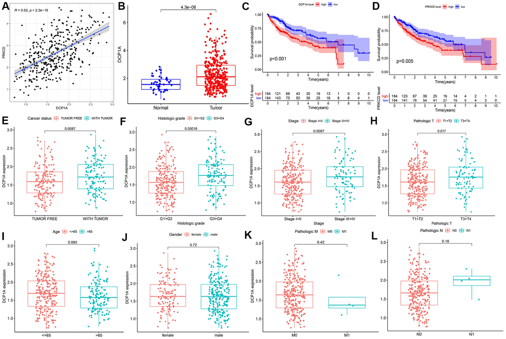 Correlation between DCP1A and clinicopathological variables. (A) Relationship between DCP1A and the predicted target gene PRKCD. (B) Expression level of DCP1A in HCC tissue compared with the level in normal tissue. (C) High expression of eRNA DCP1A was associated with poor prognosis in HCC. (D) High expression of PRKCD was associated with poor prognosis in HCC. (E–L) Increased expression of DCP1A was significantly correlated with cancer status, histological grade, AJCC stage, and T stage, and showed insignificant correlation with age, gender, M and N stage.