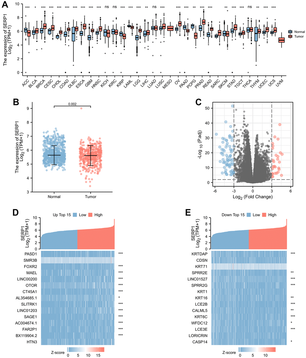 SERP1 expression in cancers. (A) SERP1 expression in different cancers and normal tissues in TCGA and GTEx pan-cancer data, ns, p ≥ 0.05; *p p p B) The SERP1 expression in SKCM and normal tissues, (C) The volcano plots of DEGs between high and low SERP1 expression groups, (D) The heatmap of top 15 up-regulated DEGs, (E) The heatmap of top 15 down-regulated DEGs.