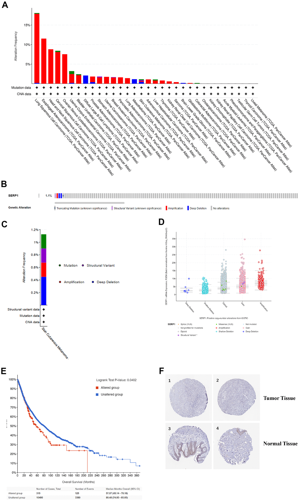 Genetic alteration and protein localization of SERP1 in SKCM patients. (A) Bar chart of SERP1 mutation in pan-cancers based on TCGA database. (B) SERP1 gene expression and mutation analysis in SKCM. (C) The distribution of SERP1 genomic alterations in SKCM. (D) The graph of the correlation between SERP1 expression and copy number alterations in SKCM. (E) Kaplan-Meier curve of OS in SKCM patients with altered (red) and unaltered (blue) mRNA expression of the SERP1 gene. (F) The representative IHC staining images from HPA database presents SERP1 expression in normal and tumor tissues.