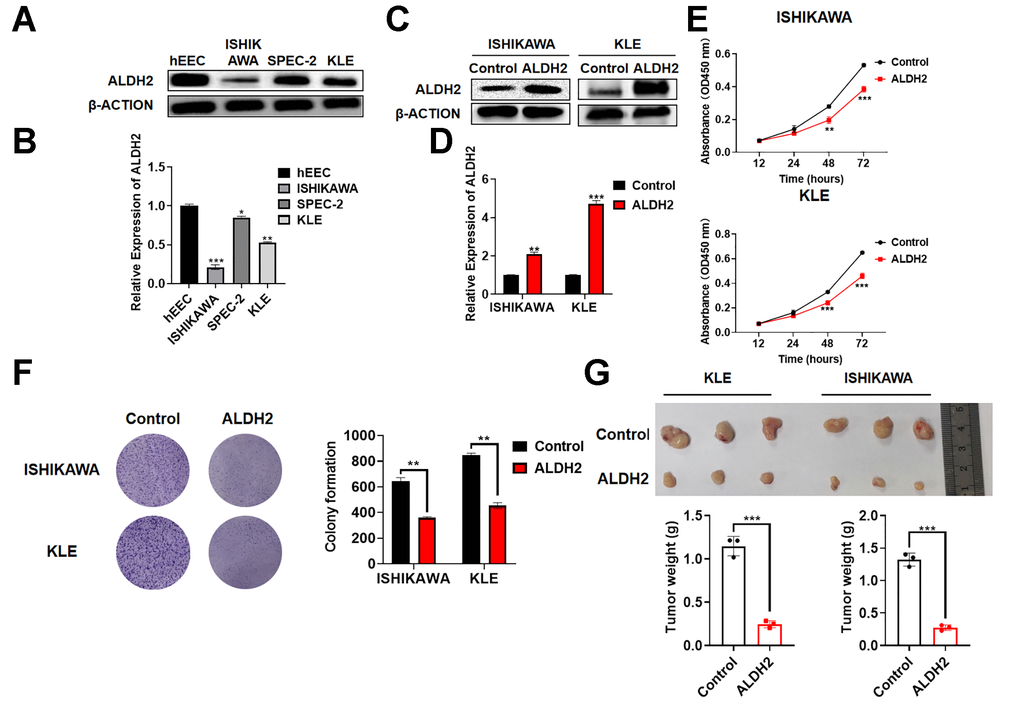 Effect of ALDH2 overexpression on tumor progression in vitro and in vivo. (A) Expression of ALDH2 in the UCEC cells by Western Blot. (B) Expression of ALDH2 in the UCEC cells by qRT-PCR. (C) Overexpression efficiency of ALDH2 by Western Blot. (D) Overexpression efficiency of ALDH2 by qRT-PCR. (E) CCK-8 assays OD 450 nm. (F) Colony formation ability was determined using colony formation assays. (G) Tumor xenografts from nude mice subsequent assays. *P **P ***P 