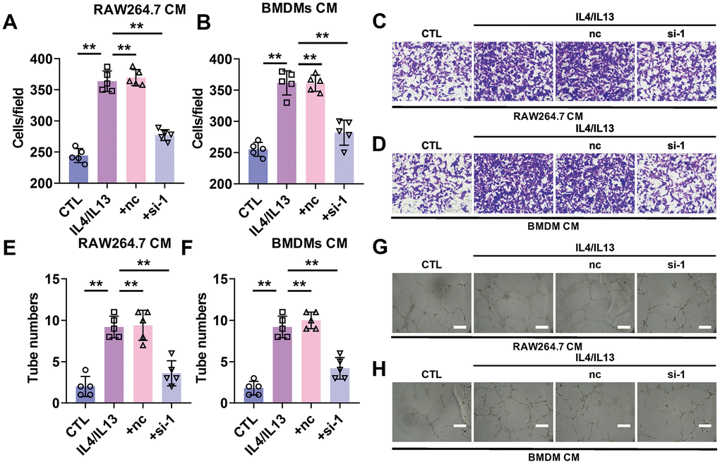 Silencing of lncRNA-SNHG1 attenuated the pro-angiogenesis effect of M2 macrophage. MCF-7 cells were cultured using condition medium from RAW264.7 cells or BMDMs for 24 hours. (A–D) Cell migration of MCF-7 cells cultured with RAW264.7 cells condition medium (A, C) or BMDMs (B, D) were assessed by Transwell assay. one-way ANOVA was used for the statistical analysis. n=5 independent cell cultures. The bar indicates the SD values. **PE–H) Tube formation of HUVEC cells was counted in the presence of the condition medium from RAW264.7 cells (E, G) or BMDMs (F, H). one-way ANOVA was used for the statistical analysis. n=5 independent cell cultures. The bar indicates the SD values. **P