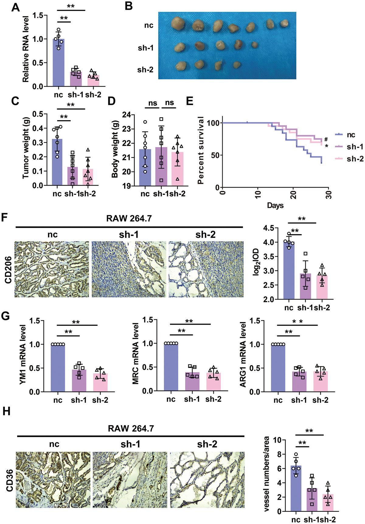 Silencing of lncRNA-SNHG1 in RAW264.7 cells inhibited tumor growth and angiogenesis. (A) qRT-PCR analysis was performed to measure the RNA level of lncRNA-SNHG1 after transfection of Adv-lncRNA-SNHG1 in RAW264.7 cells. Two-tailed t-test was used for the statistical analysis. n=5 independent cell cultures. The bar indicates the SD values. **PB, C) The tumors formed in mice at the endpoint of mice study. Two-tailed t-test was used for the statistical analysis. n=7 mice per group. The bar indicates the SD values. **PD) Body weight of mice was measured at the endpoint of mice study. Two-tailed t-test was used for the statistical analysis. n=7 mice per group. The bar indicates the SD values. **PE) Survival curve was shown by counting dead mice of three groups. n=20 mice per group. #PF) IHC staining of CD206 of tumor tissues was performed. Two-tailed t-test was used for the statistical analysis. n=5 mice per group. The bar indicates the SD values. **PG) qRT-PCR analysis was performed to measure the RNA level of M2 polarization markers in tumor tissues. n=5 mice per group. The bar indicates the SD values. **PH) IHC staining of CD31 of tumor tissues was performed. Two-tailed t-test was used for the statistical analysis. n=5 mice per group. The bar indicates the SD values. **P