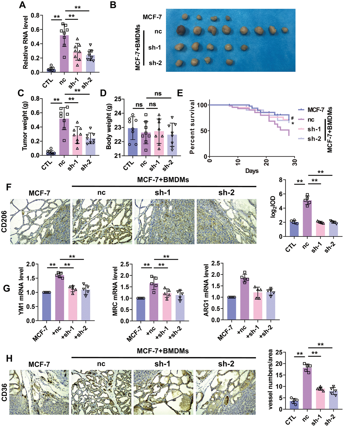 Silencing of lncRNA-SNHG1 suppressed BMDMs-induced tumor growth and angiogenesis. (A) qRT-PCR analysis was performed to measure the RNA level of lncRNA-SNHG1 after transfection of Adv-lncRNA-SNHG1 in BMDMs. Two-tailed t-test was used for the statistical analysis. n=5 independent cell cultures. The bar indicates the SD values. **PB, C) The tumors formed in mice at the endpoint of mice study. Two-tailed t-test was used for the statistical analysis. n=7 mice per group. The bar indicates the SD values. **PD) Body weight of mice was measured at the endpoint of mice study. Two-tailed t-test was used for the statistical analysis. n=7 mice per group. The bar indicates the SD values. **PE) Survival curve was shown by counting dead mice of three groups. n=20 mice per group. #PF) IHC staining of CD206 of tumor tissues was performed. Two-tailed t-test was used for the statistical analysis. n=5 mice per group. The bar indicates the SD values. **PG) qRT-PCR analysis was performed to measure the RNA level of M2 polarization markers in tumor tissues. n=5 mice per group. The bar indicates the SD values. **PH) IHC staining of CD31 of tumor tissues was performed. Two-tailed t-test was used for the statistical analysis. n=5 mice per group. The bar indicates the SD values. **P