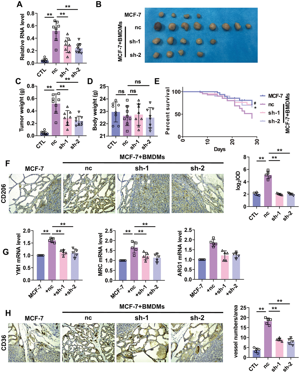 Silencing of lncRNA-SNHG1 suppressed BMDMs-induced tumor growth and angiogenesis. (A) qRT-PCR analysis was performed to measure the RNA level of lncRNA-SNHG1 after transfection of Adv-lncRNA-SNHG1 in BMDMs. Two-tailed t-test was used for the statistical analysis. n=5 independent cell cultures. The bar indicates the SD values. **PB, C) The tumors formed in mice at the endpoint of mice study. Two-tailed t-test was used for the statistical analysis. n=7 mice per group. The bar indicates the SD values. **PD) Body weight of mice was measured at the endpoint of mice study. Two-tailed t-test was used for the statistical analysis. n=7 mice per group. The bar indicates the SD values. **PE) Survival curve was shown by counting dead mice of three groups. n=20 mice per group. #PF) IHC staining of CD206 of tumor tissues was performed. Two-tailed t-test was used for the statistical analysis. n=5 mice per group. The bar indicates the SD values. **PG) qRT-PCR analysis was performed to measure the RNA level of M2 polarization markers in tumor tissues. n=5 mice per group. The bar indicates the SD values. **PH) IHC staining of CD31 of tumor tissues was performed. Two-tailed t-test was used for the statistical analysis. n=5 mice per group. The bar indicates the SD values. **P