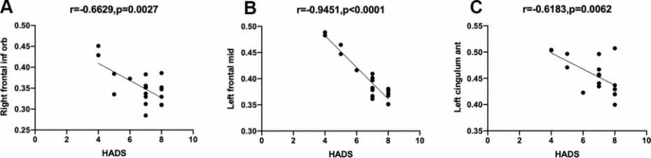 Correlation between the mean GMV and severity of HADS in different brain areas. Notes: (A) The GMV value of the right inferior frontal gyrus of the nAMD group portrayed a non-linear correlation with the severity of HADS (r=-0.6629, P=0.0027). (B) The GMV value of the left middle frontal gyrus of the nAMD group portrayed a non-linear correlation with the severity of HADS(r=-0.9451, pC) The GMV value of the left anterior cingulate and paracingulate gyrus of the nAMD group portrayed a non-linear correlation with the severity of HADS(r=-0.6183, p=0.0062). Abbreviations: GMV, gray matter volume; HADS, hospital anxiety and depression scale; nAMD, neovascular age-related macular degeneration.