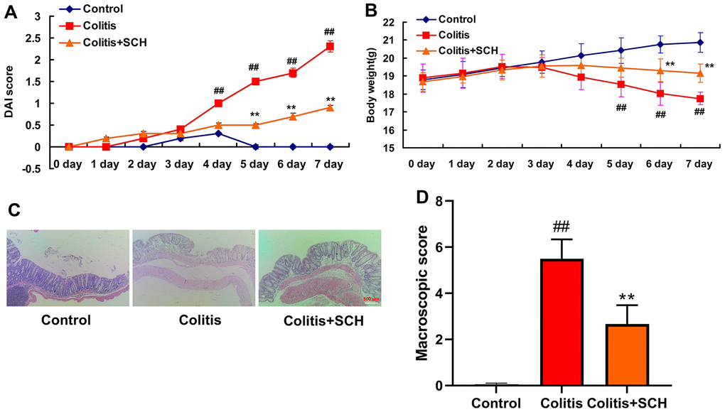 Schisandrin B presented colitis in mice model. (A) DAI score; (B) weight of mice; (C) HE staining results of colon (×200); (D) Colon macroscopic score. ##P