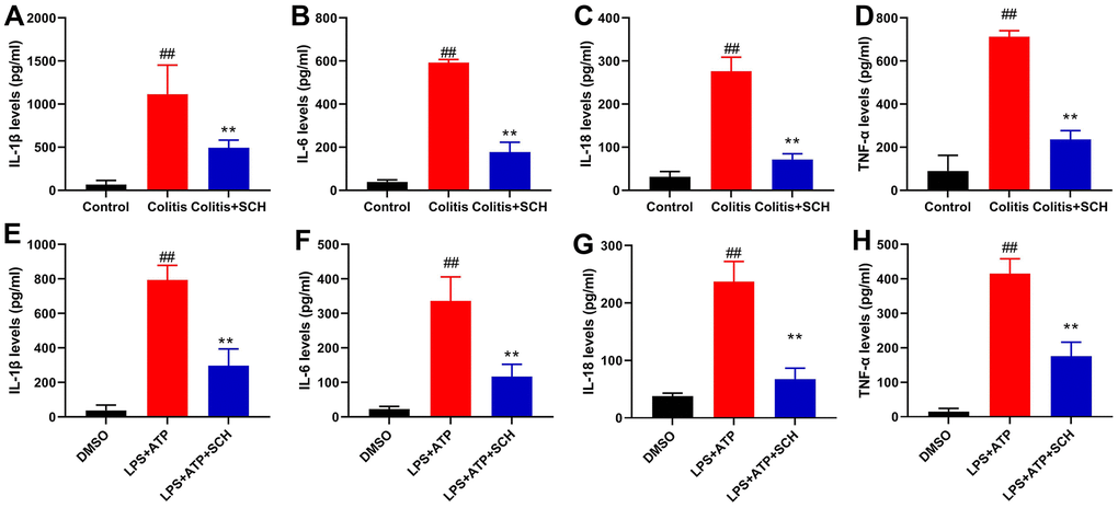 Schisandrin B reduced inflammation in vivo and vitro model of colitis. (A–D) The levels of TNF-α, IL-6, IL-1β and IL-18 in colon tissue; (E–H) the levels of TNF-α, IL-6, IL-1β and IL-18 in intestinal epithelial cells. ##P