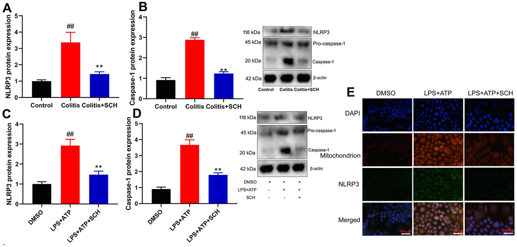Schisandrin B suppressed NLRP3 inflammasone in vivo and vitro model of colitis. (A, B) the protein expression of NLRP3 and caspase-1 in mouse colon tissue; (C, D) the protein expression of NLRP3 and caspase-1 in intestinal epithelial cells induced by LPS + ATP; (E) the protein expression of NLRP3 and caspase-1 in intestinal epithelial cells detected by cell immunofluorescence. ##P