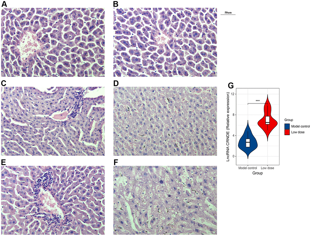 Successfully constructed alcoholic liver disease mice model. (A) HE staining image of blank group. (B) HE staining image of model control. (C, D). HE staining image of low dose group. (E, F) HE staining image of high dose group. (G) qRT-PCR was performed to detect relative lnc CRNDE expression in low dose group and model control group. *P P P 