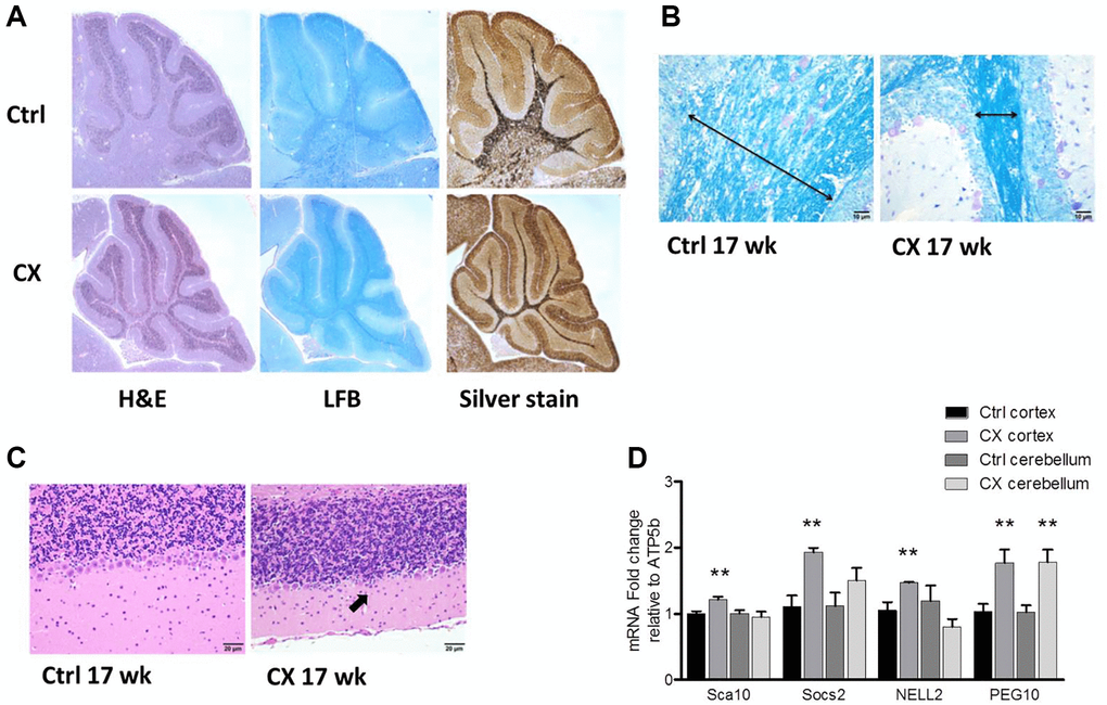 Neurodegeneration and myelin loss in CX mice. (A) Hematoxylin and Eosin (H&E), Luxol fast blue (LFB), and silver staining of cerebellum of pre-weaning control and CX animals. (B) Luxol fast blue staining of cerebellum from 17-week old control and CX animals. Myelin content length indicated by arrow. (C) Hematoxylin and Eosin staining of the Purkinje cell layer of animals described in b. CX mice display degeneration of the Purkinje cell layer (arrow). n = 2. (D) Gene expression of control and CX cortex and cerebellum for PARP-1 regulated genes, n = 8. Data are presented as mean ± SE. Student’s t-test. *P **P 