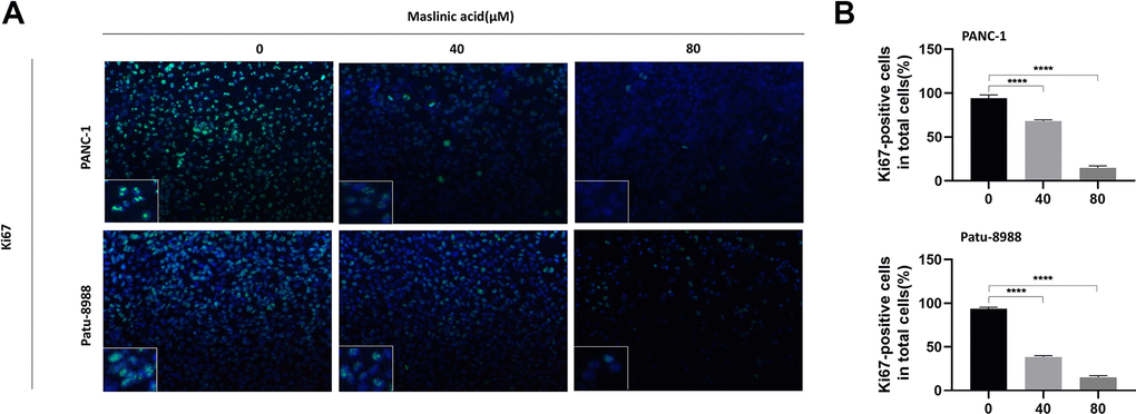 MA-induced inhibition of the expression of ki67 protein of pancreatic cancer cells. (A) Ki67 Immunofluorescence following PANC-1 and Patu-8988 cells incubation with MA (0, 40, 80 μM) for 24 h. Scale bar =50μm. (B) Quantitative analysis of Ki67 positive cells in different groups. Data are representative of three independents experiments and expressed as mean ± SD. ****p 