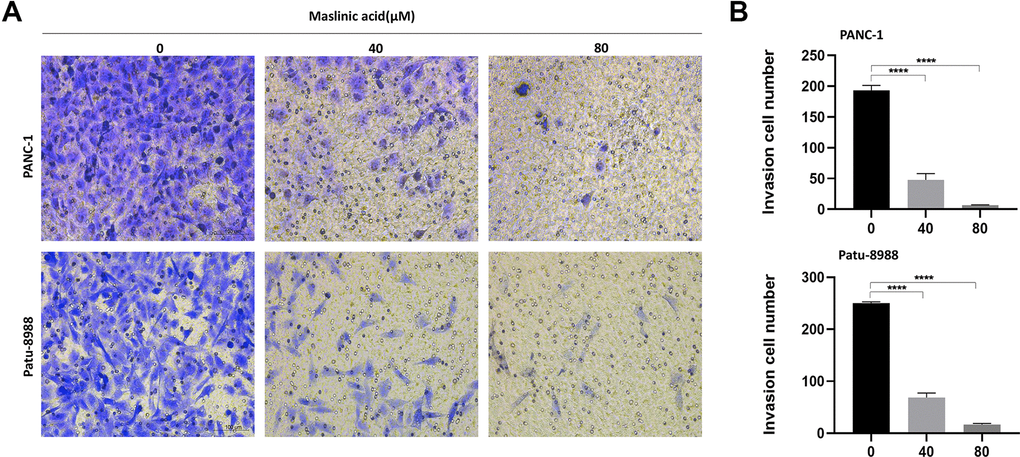 MA-mediated inhibition of the invasion of pancreatic cancer cells. (A) Transwell assay following PANC-1 and Patu-8988 cells incubated with MA (0, 40, 80 μM) for 24 h demonstrating that MA significantly inhibited invasion of PANC-1 and Patu-8988 cells of pancreatic cancer. in a concentration-dependent manner. (B) The quantification results of invasion cell number. Data are representative of three independent experiments and expressed as mean ± SD. ****p 