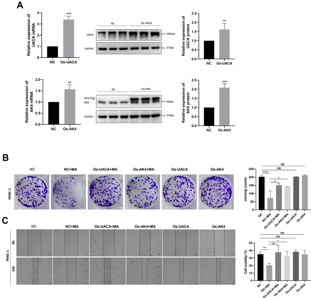 Overexpression of UACA and AK4 abolishes the MA-mediated anti-tumor effect. (A) QRT-PCR and western blot analysis of the expression of UACA and AK4 in NC, oe-UACA, oe-AK4 groups of PANC-1 cells. (B) Colony formation assay analysis of cell proliferation in NC, NC+MA (40μM MA treated for 24 h), oe-UACA+MA (40μM MA treated for 24 h), oe-AK4+MA (40μM MA treated for 24 h), oe-UACA, oe-AK4 groups of PANC-1 cells. (C) Wound healing assay analysis of cell migration in NC, oe-UACA+MA (40μM MA treated for 24 h), oe-AK4+MA (40μM MA treated for 24 h), oe-UACA, oe-AK4 groups of PANC-1 cells. Bar =200 μm. Data are presented as fold change and as mean ± SD of three independent experiments. *p 