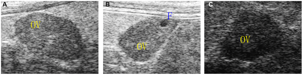 Ovarian morphology under ultrasound. (A) Normal group; (B) Natural aging non-intervention group; (C) Natural aging intervention group; OV, ovary; F, follicle.