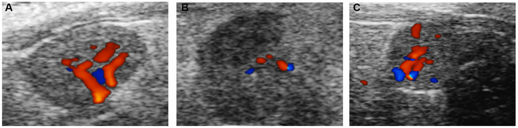 Ovarian blood flow under ultrasound. (A) Normal group; (B) Natural aging non-intervention group; (C) Natural aging intervention group.