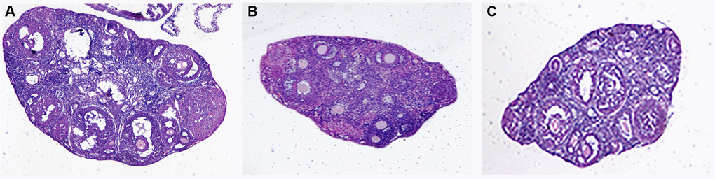 Ovarian tissue sections. (A) Normal group; (B) Natural aging non-intervention group; (C) Natural aging intervention group (X40).