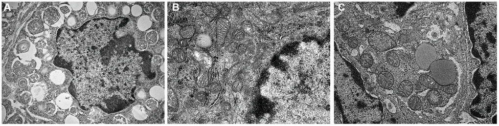 Mitochondrial morphology under electron microscope. (A) Normal group; (B) Natural aging non-intervention group; (C) Natural aging intervention group (X5000).